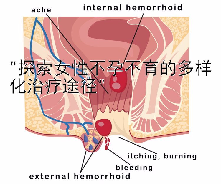 探索女性不孕不育的多样化治疗途径