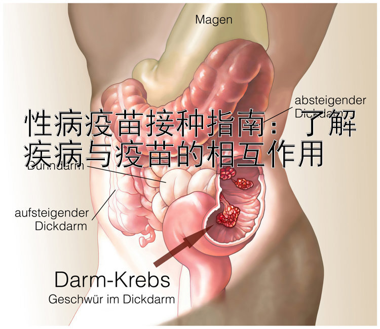 性病疫苗接种指南：了解疾病与疫苗的相互作用