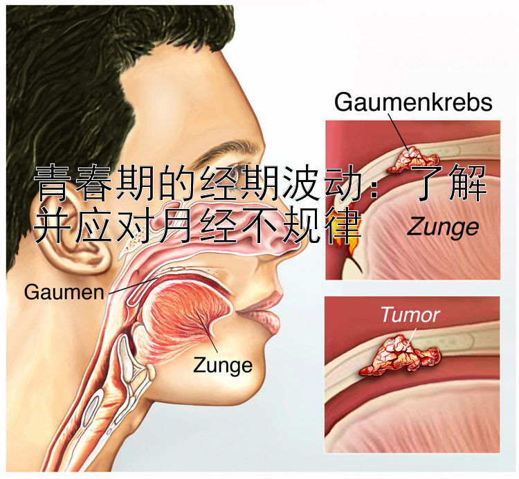 青春期的经期波动：了解并应对月经不规律