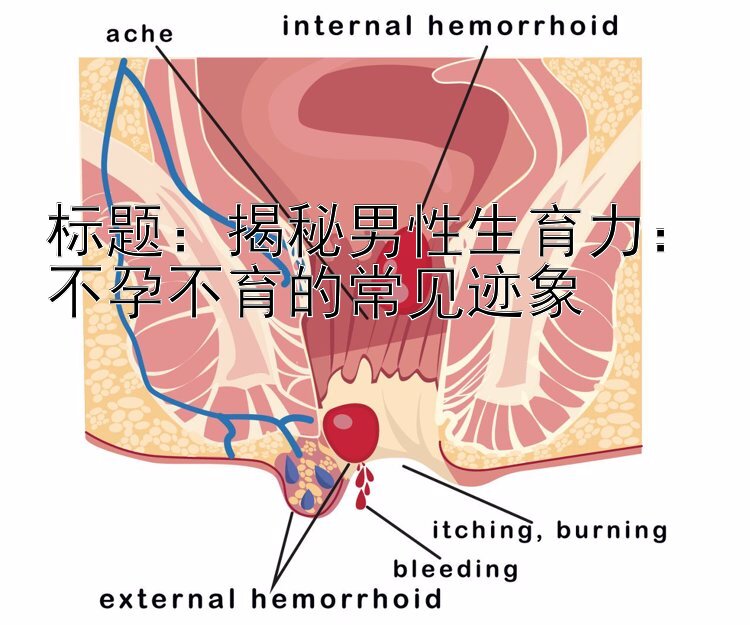 揭秘男性生育力：不孕不育的常见迹象