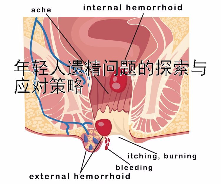 年轻人遗精问题的探索与应对策略