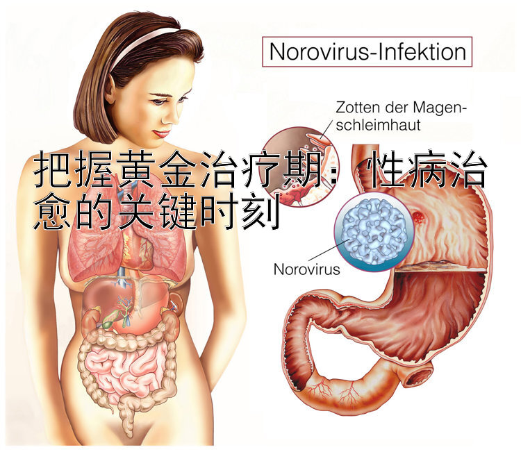 把握黄金治疗期：性病治愈的关键时刻