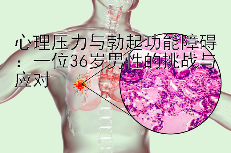 心理压力与勃起功能障碍：一位36岁男性的挑战与应对