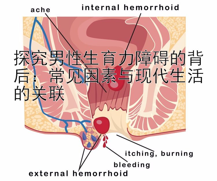 探究男性生育力障碍的背后：常见因素与现代生活的关联