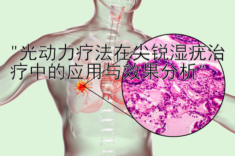 光动力疗法在尖锐湿疣治疗中的应用与效果分析