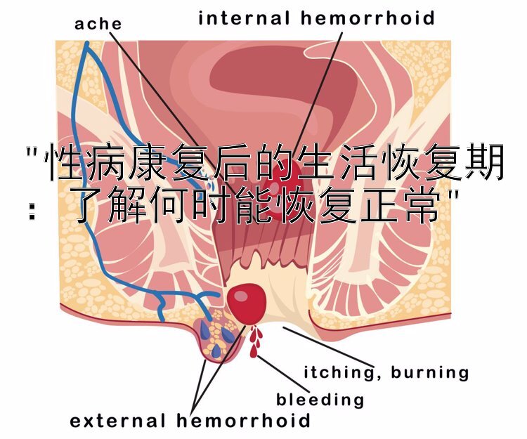 性病康复后的生活恢复期：了解何时能恢复正常