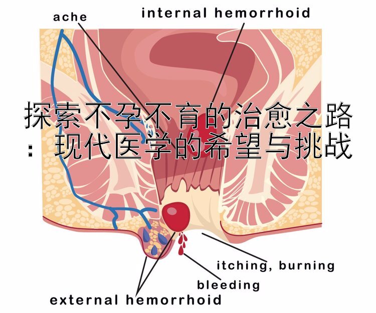 探索不孕不育的治愈之路：现代医学的希望与挑战