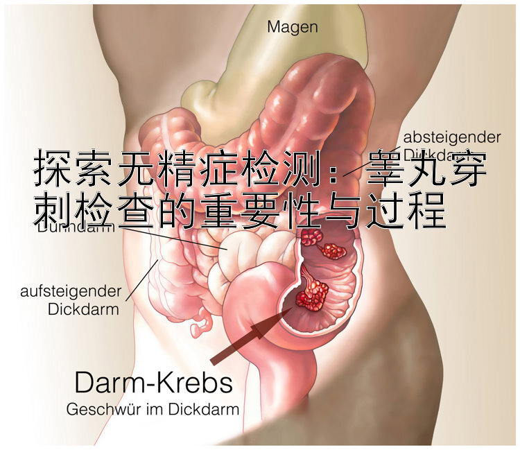 探索无精症检测：睾丸穿刺检查的重要性与过程