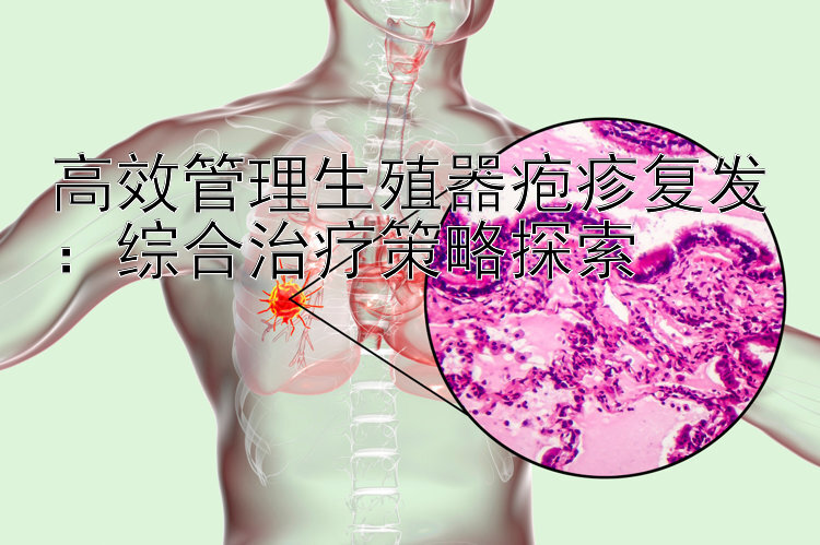 高效管理生殖器疱疹复发：综合治疗策略探索