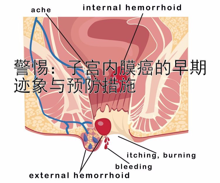 警惕：子宫内膜癌的早期迹象与预防措施