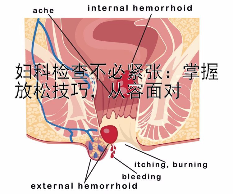 妇科检查不必紧张：掌握放松技巧，从容面对