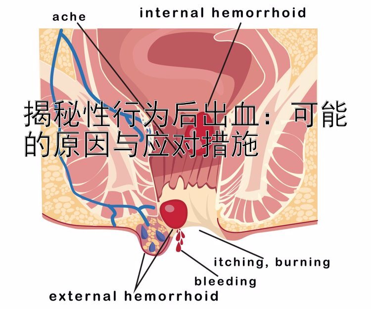 揭秘性行为后出血：可能的原因与应对措施