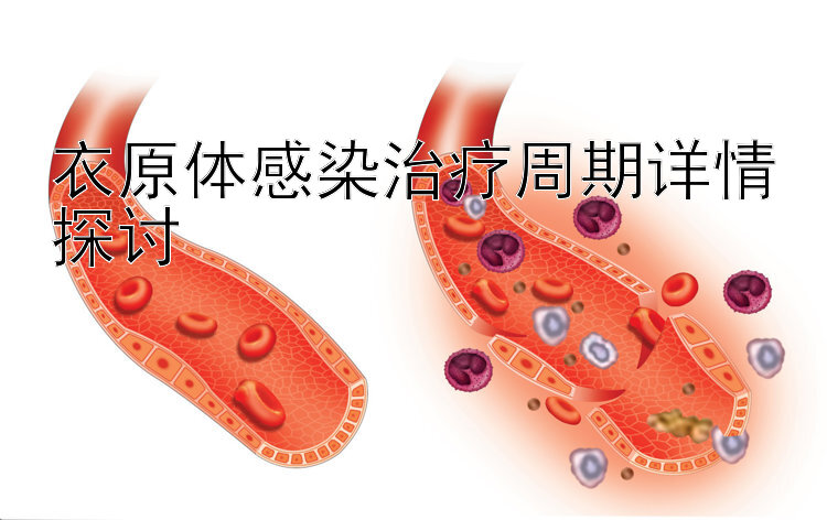 衣原体感染治疗周期详情探讨