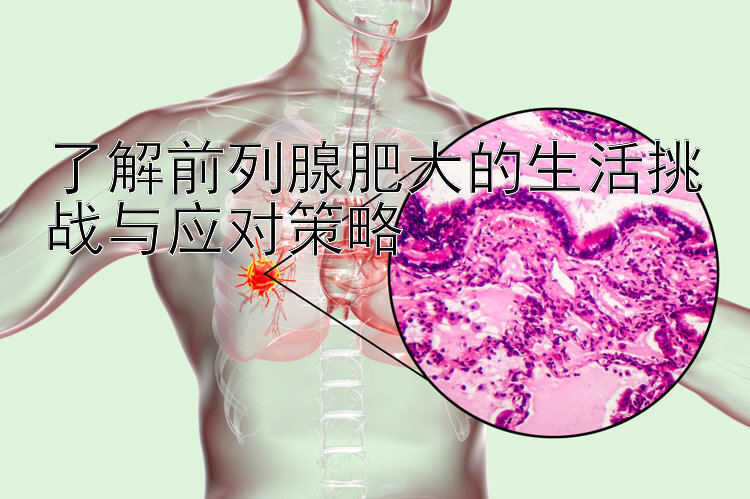 了解前列腺肥大的生活挑战与应对策略