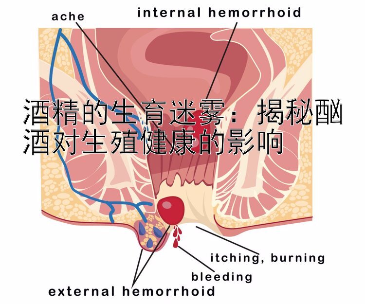 酒精的生育迷雾：揭秘酗酒对生殖健康的影响