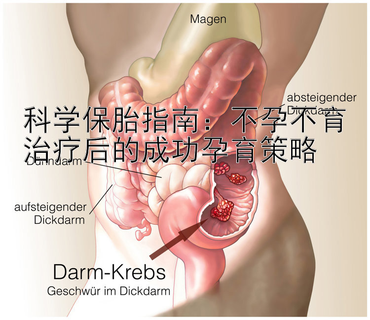 科学保胎指南：不孕不育治疗后的成功孕育策略