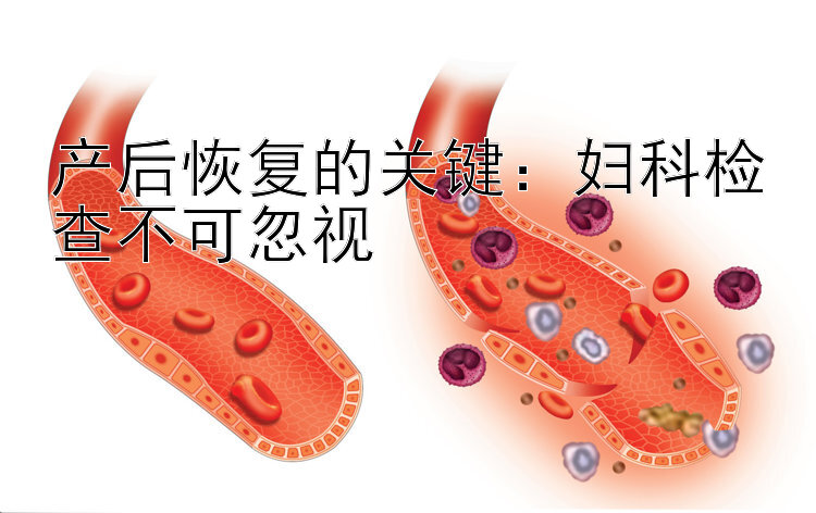 产后恢复的关键：妇科检查不可忽视