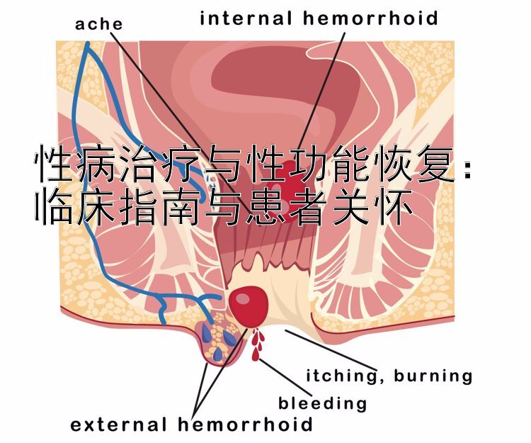 性病治疗与性功能恢复：临床指南与患者关怀