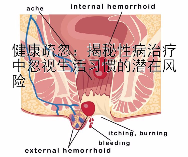 健康疏忽：揭秘性病治疗中忽视生活习惯的潜在风险