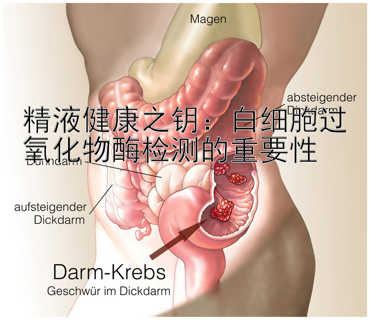 精液健康之钥：白细胞过氧化物酶检测的重要性