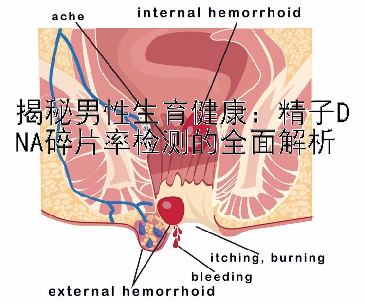 揭秘男性生育健康：精子DNA碎片率检测的全面解析