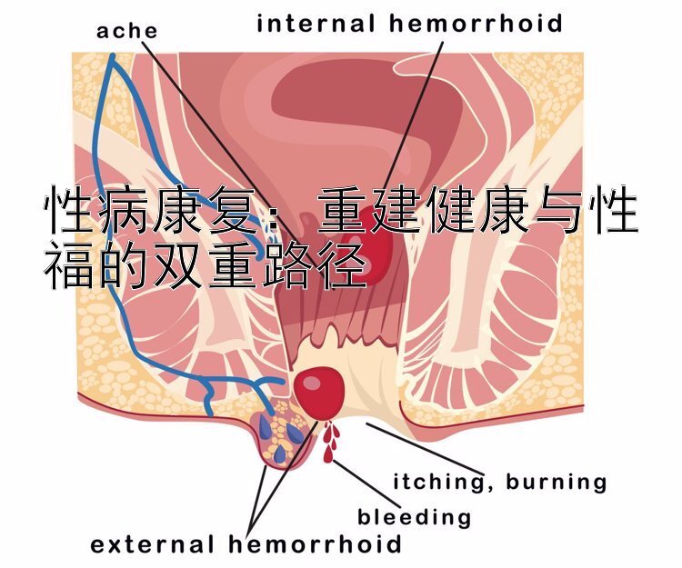 乐发ll最新稳定邀请码   性病康复：重建健康与性福的双重路径