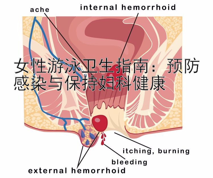 女性游泳卫生指南：预防感染与保持妇科健康