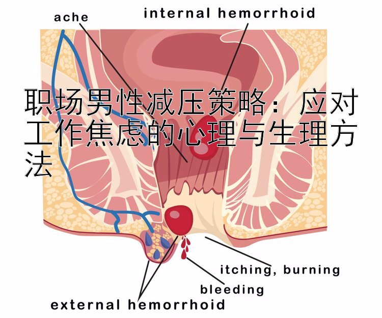 职场男性减压策略：应对工作焦虑的心理与生理方法