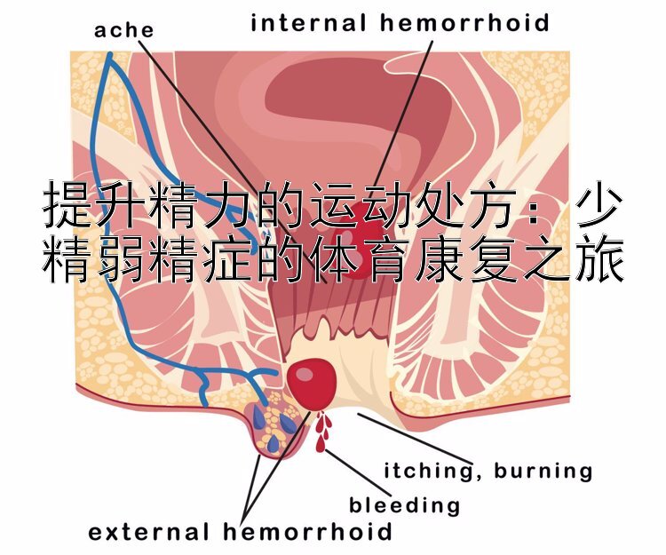 提升精力的运动处方：少精弱精症的体育康复之旅