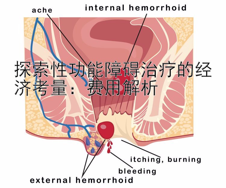 探索性功能障碍治疗的经济考量：费用解析