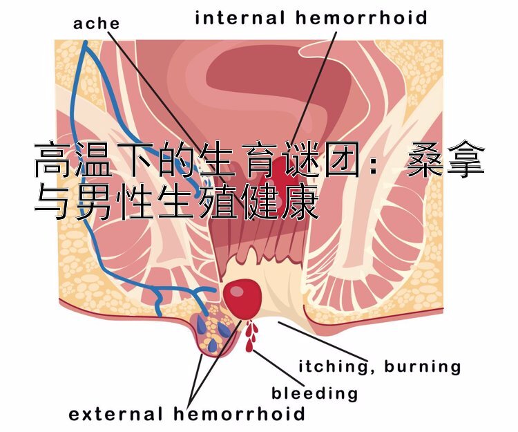 高温下的生育谜团：桑拿与男性生殖健康