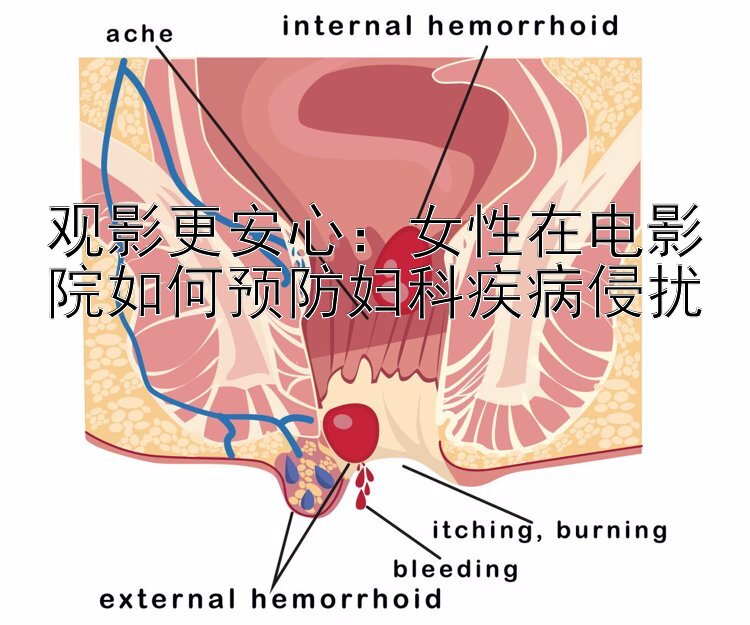 观影更安心：女性在电影院如何预防妇科疾病侵扰