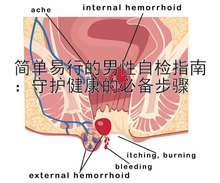 简单易行的男性自检指南：守护健康的必备步骤