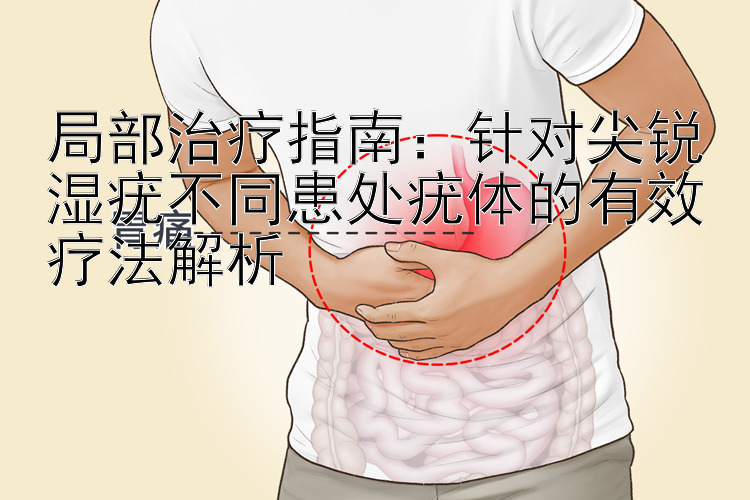 局部治疗指南：针对尖锐湿疣不同患处疣体的有效疗法解析