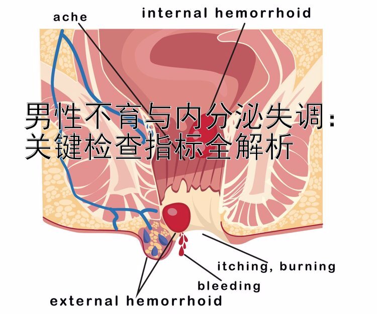 男性不育与内分泌失调：关键检查指标全解析