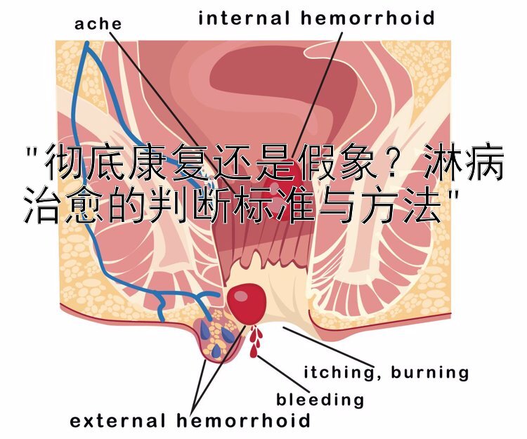 彻底康复还是假象？淋病治愈的判断标准与方法