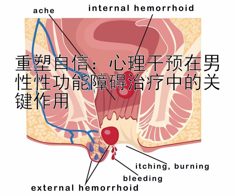 重塑自信：心理干预在男性性功能障碍治疗中的关键作用