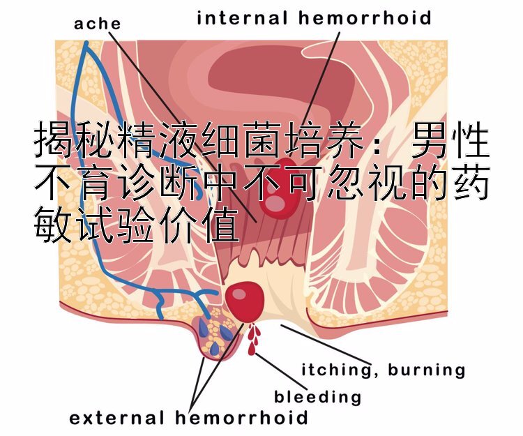 揭秘精液细菌培养：男性不育诊断中不可忽视的药敏试验价值