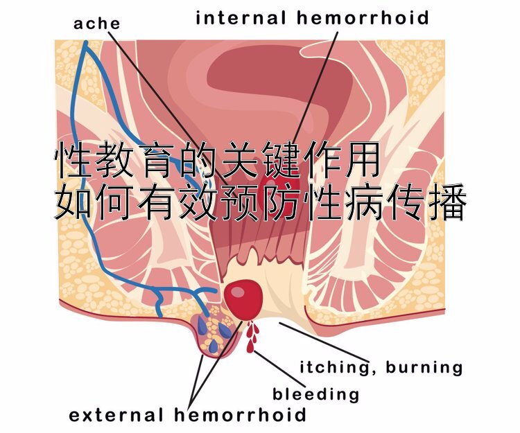 性教育的关键作用  
如何有效预防性病传播