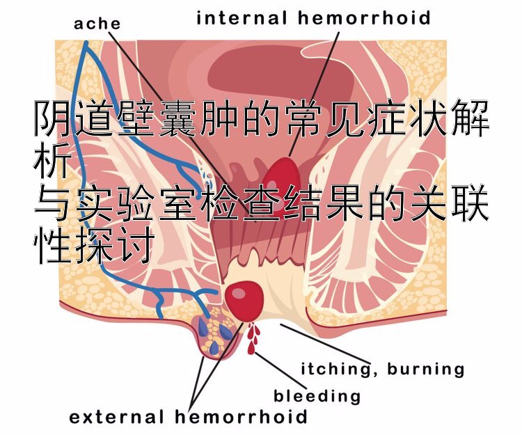 阴道壁囊肿的常见症状解析  
与实验室检查结果的关联性探讨